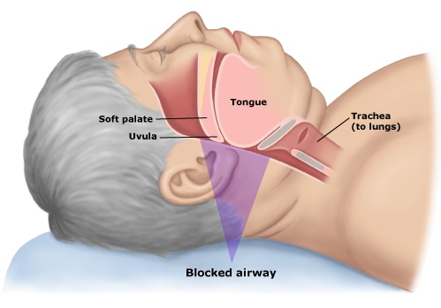 external image apnea-suenio-instrulab.jpg